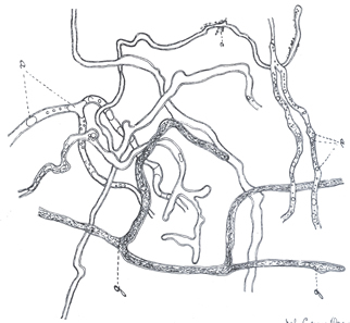 Image 1-Pythium insidiosum